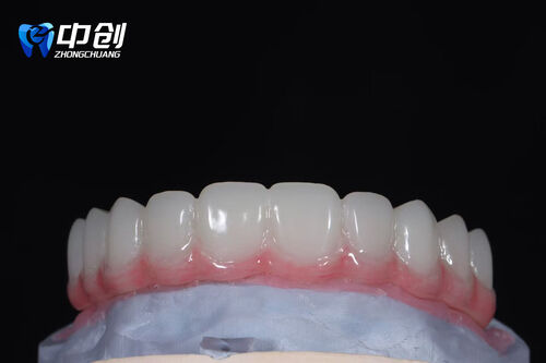 Latest company news about Dental Adhesives Product Introduction