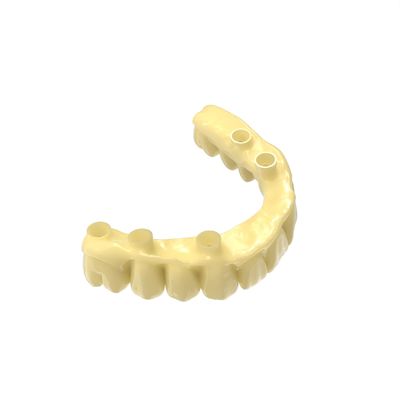 Transparent Biocompatible 3D Printing Resin for Dental Crowns